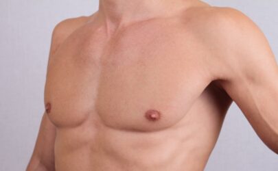 Torsoplastie : indications et résultats à Paris avec le Dr Brault