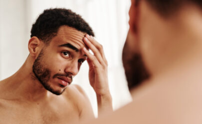 Frontoplastie cisgenre | Dr Brault | Paris